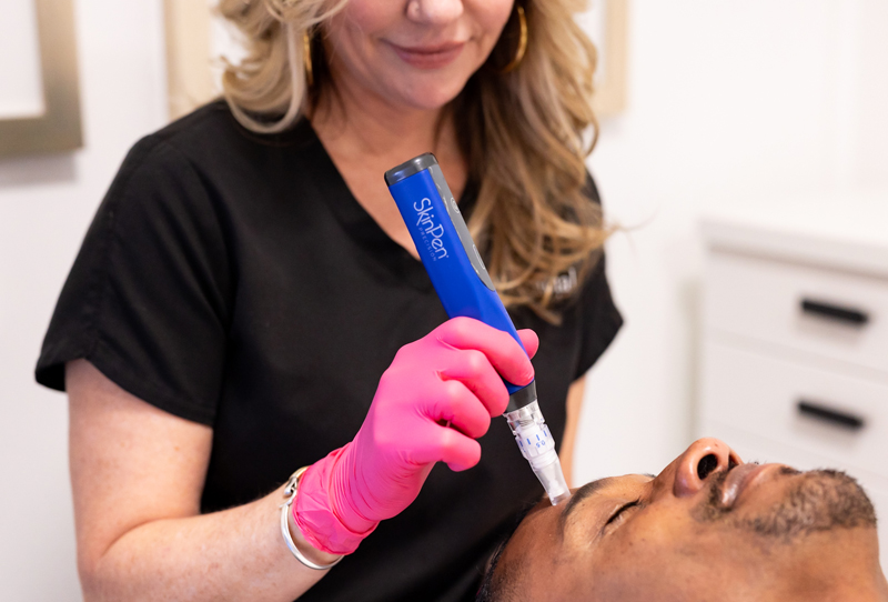 a woman treating her client with the SkinPen Microneedling theraphy